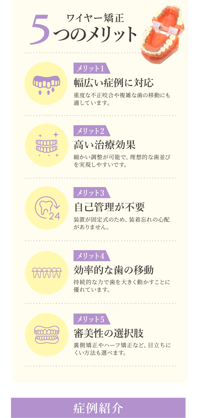 ワイヤー矯正の５つのメリット