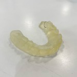 裏側矯正　セットアップモデル