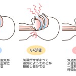 睡眠時無呼吸症候群
