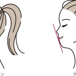 アデノイド顔貌