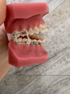 ボックスエラス