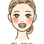 ガミースマイル