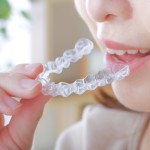 マウスピース矯正