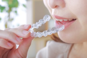 マウスピース矯正